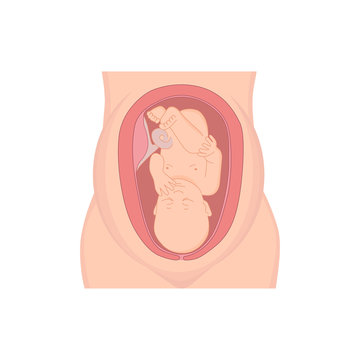 fetus inside womb, medical diagram clip art preview