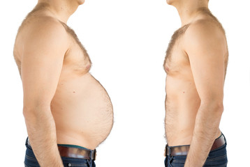 Man before and after weight loss/belly fat
