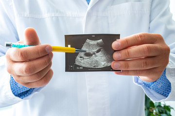 Doctor holds before itself and shows patient printed picture with ultrasound examination of...