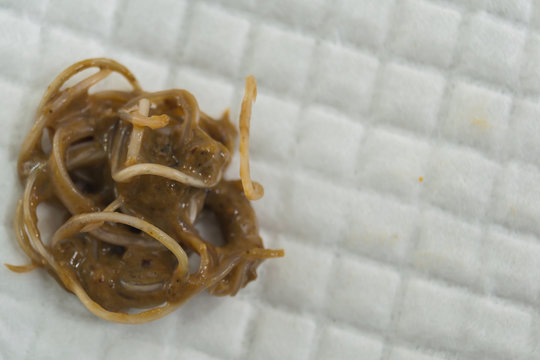 feces with Toxocara cati from a stray cat