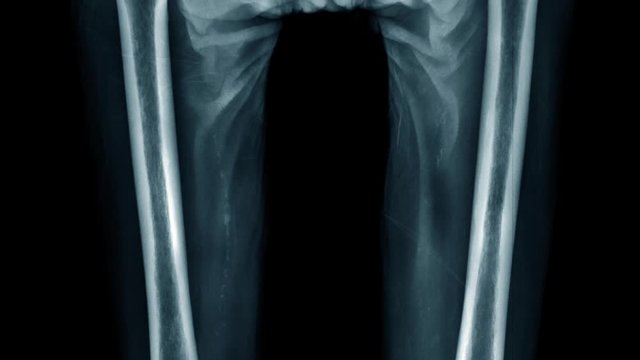 lower part of human x-ray image and sliding up 