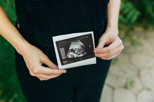 A young white woman in black overalls stands in a park and holds an ultrasound photograph of a child, close-up hands, a wedding ring on her finger