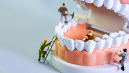Small figure worker cleaning tooth model as medical and healthcare concept, Regular checkups are essential to oral health.