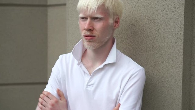portrait of an albino man outdoor dressed t shirt standing near building. abnormal deviations. unusual appearance