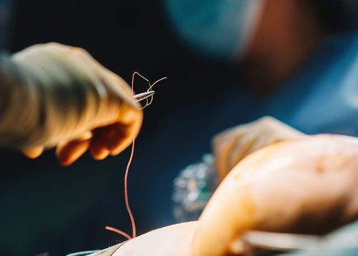 Plastic surgeon sewing up breast of female patient after inserting implants in operating room