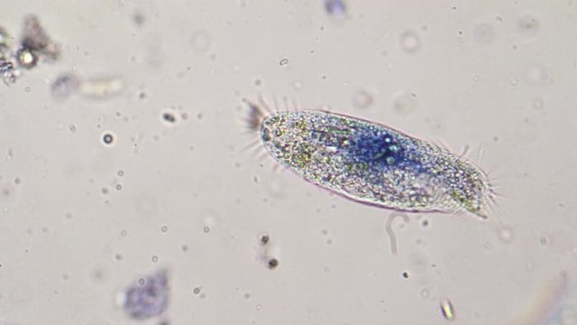 Paramecium colored blue