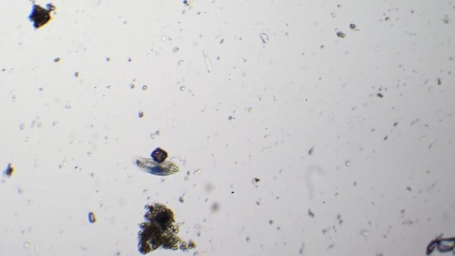 Structure of paramecium caudatum