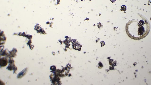 Caenorhabditis and paramecium swimming in the water of pond