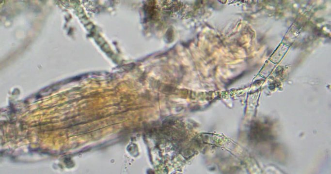 Aquatic micro fauna of drop of pond