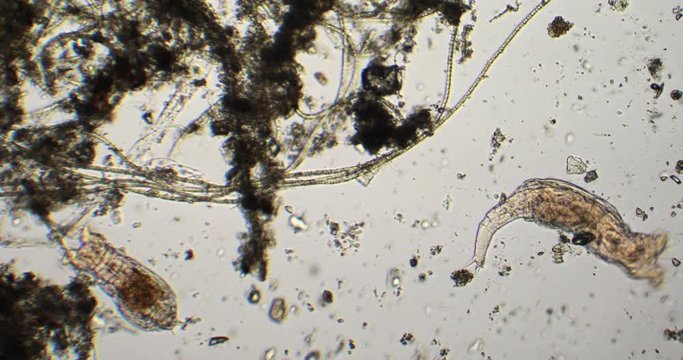 Aquatic life under microscope