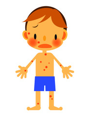男の子　発疹