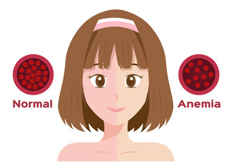 anemia vector . low red blood cell icon / women - obrazy, fototapety, plakaty