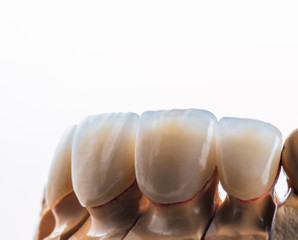 4 units natural color press ceramic veneers