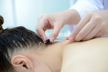 Electro-Acupuncture.Traditional Chinese acupuncture and Electroacupuncture on body of patient