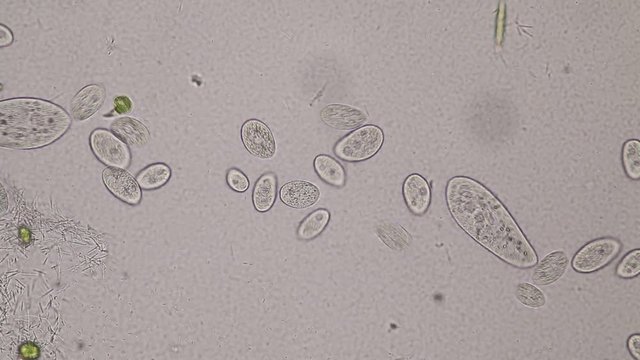 Paramecium caudatum is a genus of unicellular ciliated protozoan and Bacterium under the microscope.