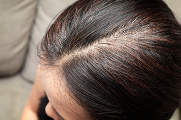Close up of white hair in asian woman. common problem of woman