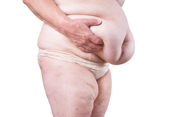 Tummy tuck, flabby skin on a fat belly, plastic surgery concept isolated on white background