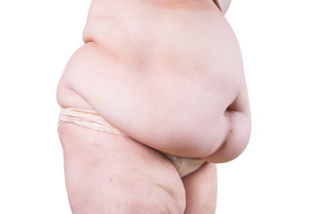 Tummy tuck, flabby skin on a fat belly, plastic surgery concept isolated on white background