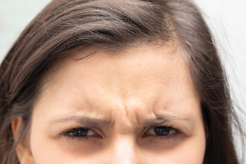 A closeup view on the frowning forehead of a young caucasian girl with brown hair, with dipped...