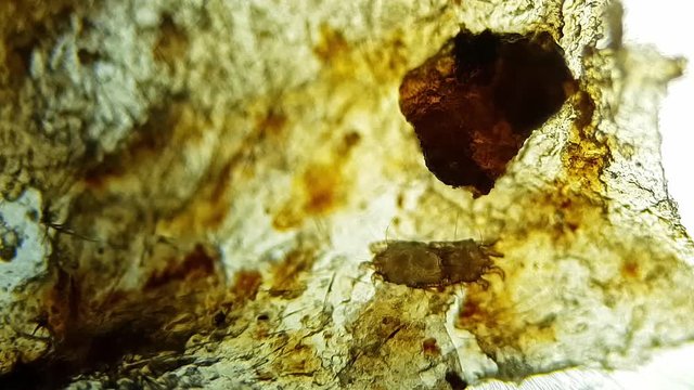 Ear swab of a cat's ear, heavy ear mite  infestation (Otodectes). Two mites breeding
