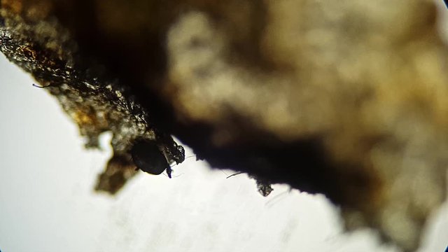 Ear swab of a cat's ear, heavy ear mite infestation (Otodectes)	