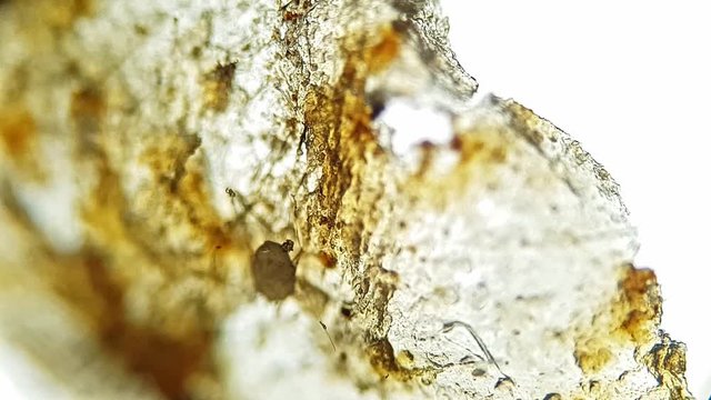 Ear swab of a cat's ear, heavy ear mite  infestation (Otodectes)