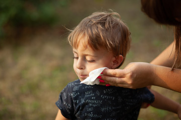 Cleaning baby face and skin with wet wipes