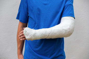 Man with broken arm wrapped medical cast plaster. Fiberglass cast covering the wrist, arm, elbow after sport accident, isolated on white