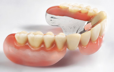Close up of a Dental implant model,denture on white background, dental plate