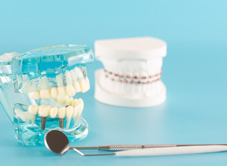 Fototapeta na wymiar Dental implant model on blue background.