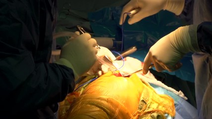 Orthopedic surgery. Hospital. Operating room. Professor, doctor, nurses, surgeon. During a medical operation. In sterile green suits.