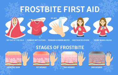 Frostbite first aid infographic. Hypothermia in cold winter