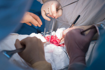 team of surgeons doing an operation. Sterile operating room. Kidney surgery