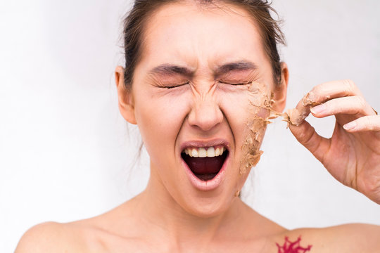 Strong peeling of the skin of a woman.