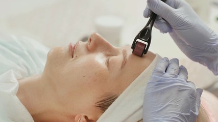 Close-up portrait of woman having beauty skin treatment. Therapist preparing skin with derma roller.