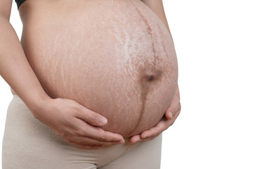 Belly of a pregnant woman with stretch marks on white background.