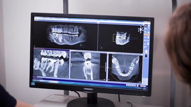 dentist and orthodontist is viewing x-rays of teeth and jaws of patient on monitor, view from back
