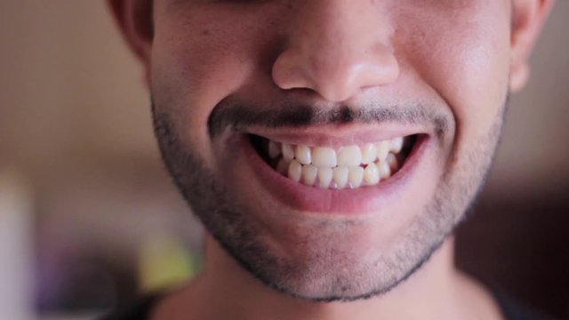 man showing his yellow teeth health dental care