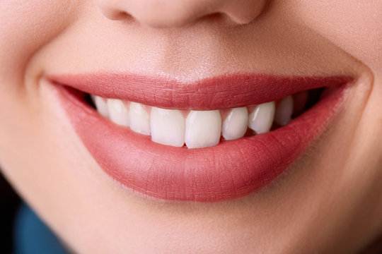 Closeup Beautiful young woman smile. Dental health. Teeth whitening.  Restoration concept