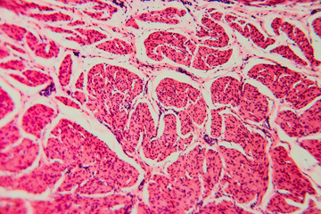 Nature background- cell bladder cat