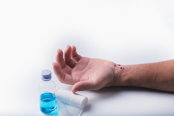 Man hand has a wound and bleeding on his wrist isolated on white background.First aid concept