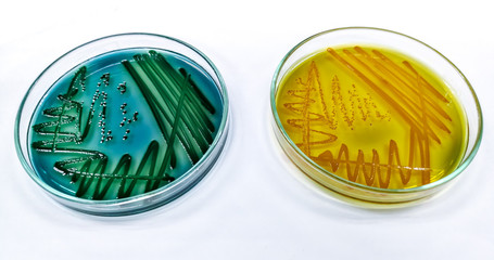 V.paraheamolyticus (L) and V.cholerae (R) on Thiosulfate-citrate-bile salts-sucrose agar 