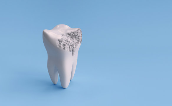 Damaged tooth isolated on blue background with clipping path. 3d render illustration