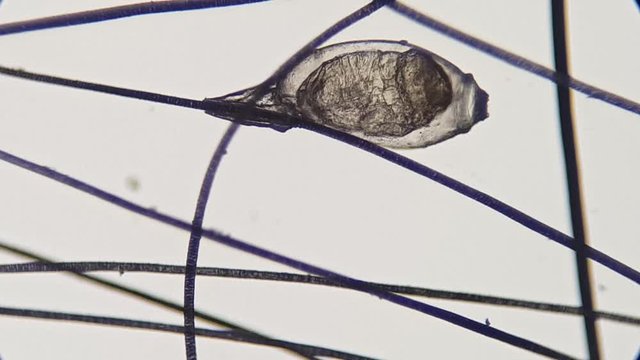 Lice egg attached to the hair, video taken with a high magnification microscope.