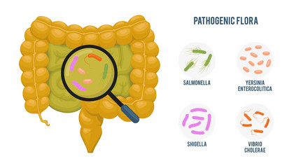 Realistic flat vector illustration:intestine, gut microflora infographic. Cartoon illustration isolated on white. Pathogenic flora: salmonella, yersinia enterocolitica, shigella, vibrio cholerae
