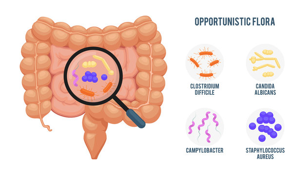 Realistic flat vector illustration:intestine, gut microflora infographic. Cartoon illustration isolated on white. Opportunistic flora:Clostridium Difficile, Candida, Campylobacter, Staphylococcus