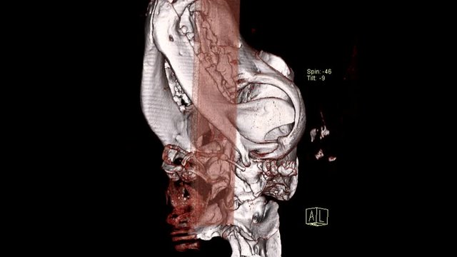 Tomography scan of a dog skull/ brain 360 rotating shot