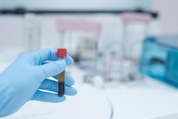 Close up scientist hand holding blood test tube during prepare specimen for auto machine analysis.Laboratory medical analysis concept.