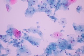 Trichomonas in pap smear on white background view in microscopic.Medical background.Cytology and pathology laboratory department.Sexually transmitted diseases.Magnification 600 X.