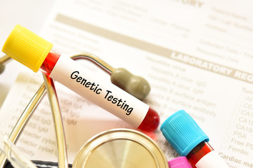 Test tube with blood sample for genetic testing